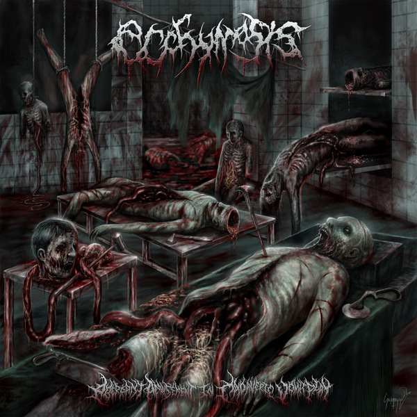 Ecchymosis