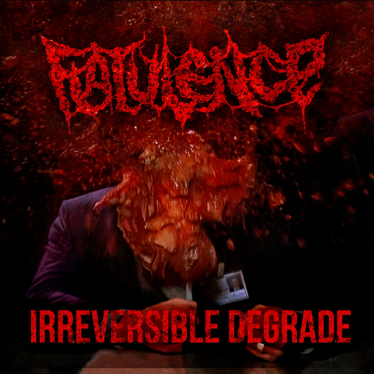 Flatulence