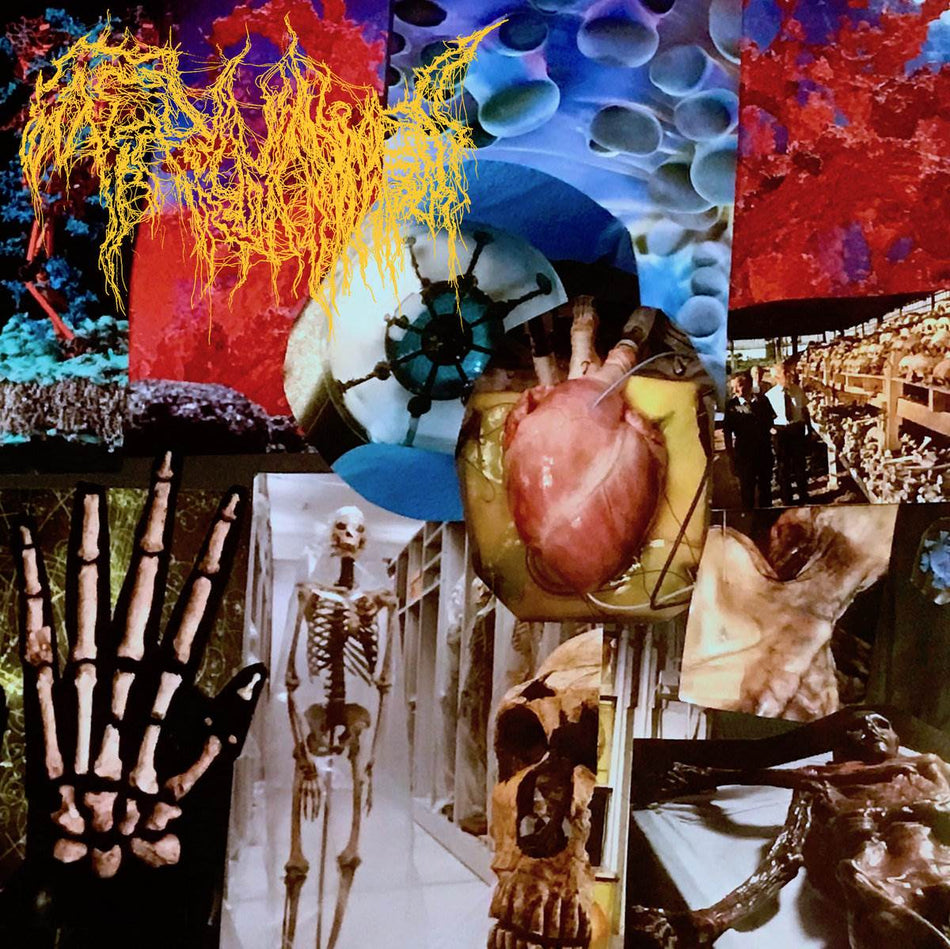 Trichomoniasis - Harvest of the Killing Fields CD