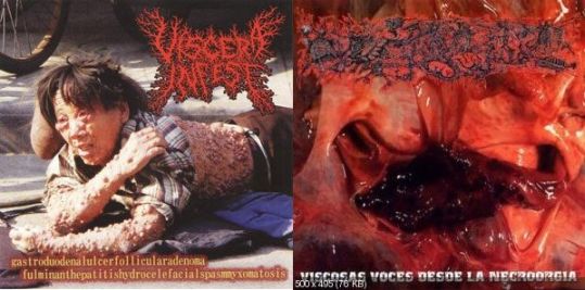 Viscera Infest / Paracoccidioidomicosisproctitissarcomucosis - Gastroduodenalulcerfollicularadenoma fulminanthepatitishydrocelefacialspasmyxomatosis / Viscosas voces desde la necroorgía CD
