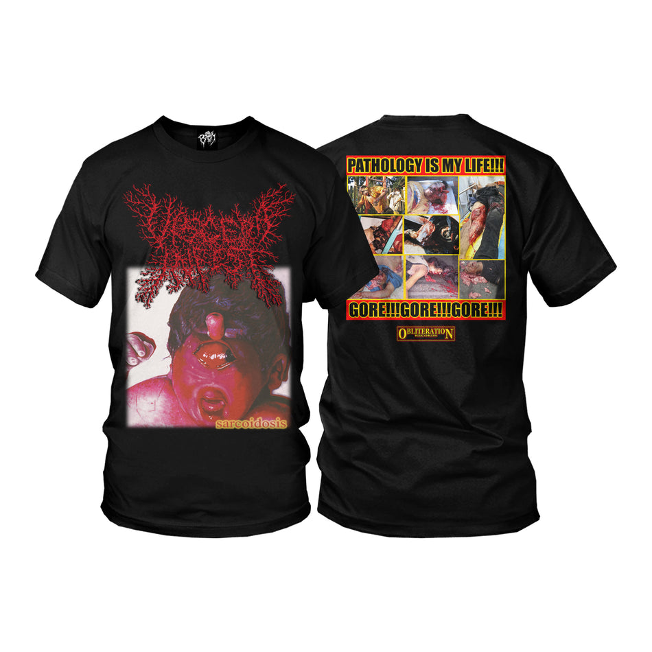 Viscera Infest - Sarcoidosis - T-Shirt