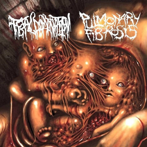 Pulmonary Fibrosis / Fetal Domination - Split CD