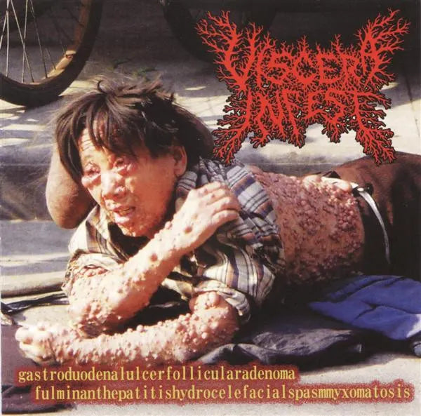 Viscera Infest / Paracoccidioidomicosisproctitissarcomucosis - Gastroduodenalulcerfollicularadenoma fulminanthepatitishydrocelefacialspasmyxomatosis / Viscosas voces desde la necroorgía CD
