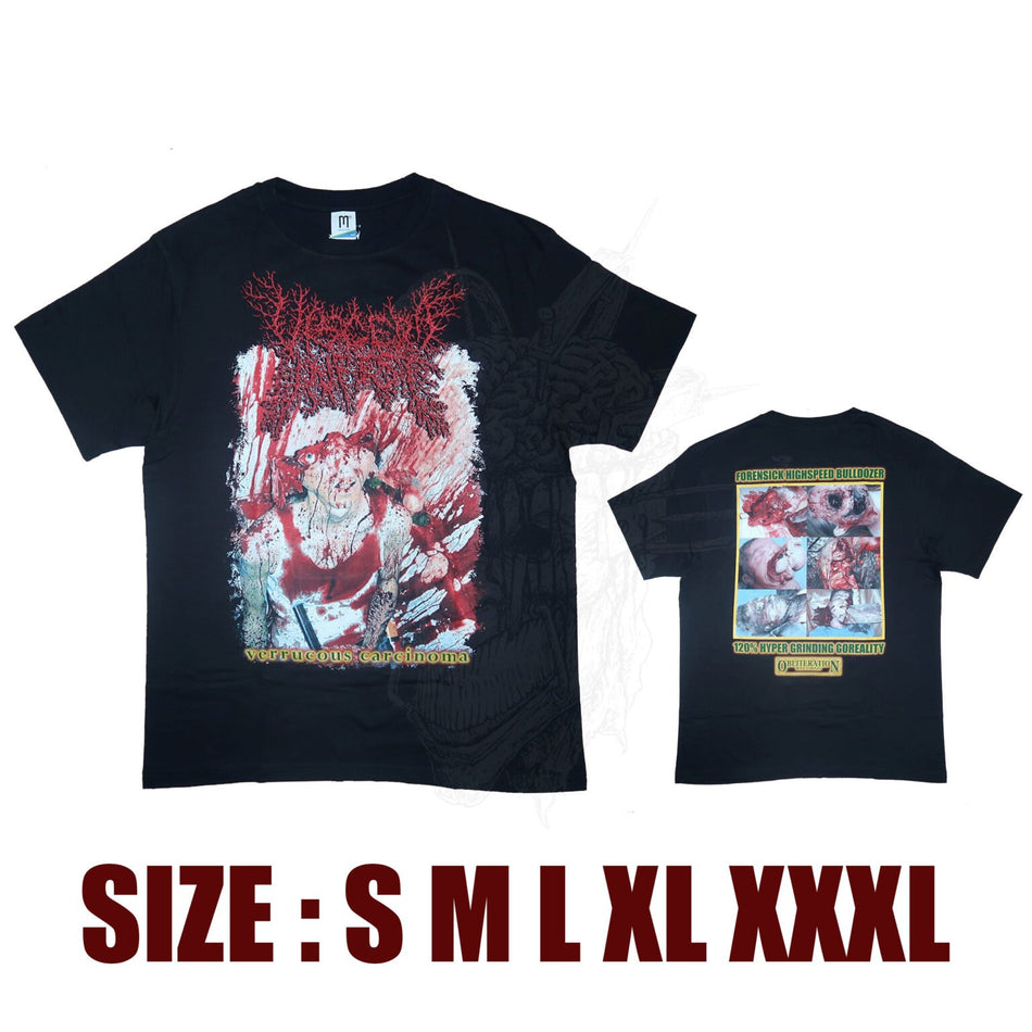Viscera Infest - Verrucous Carcinoma - T-Shirt