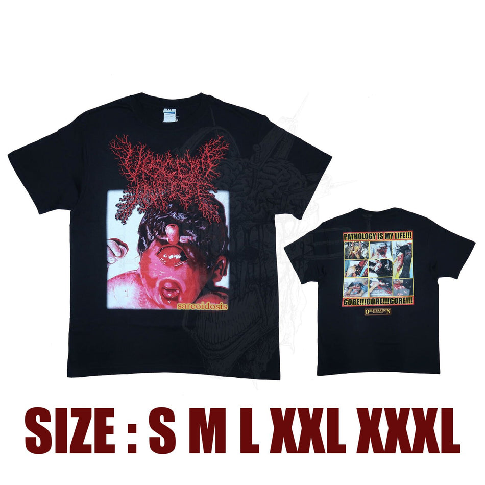 Viscera Infest - Sarcoidosis - T-Shirt
