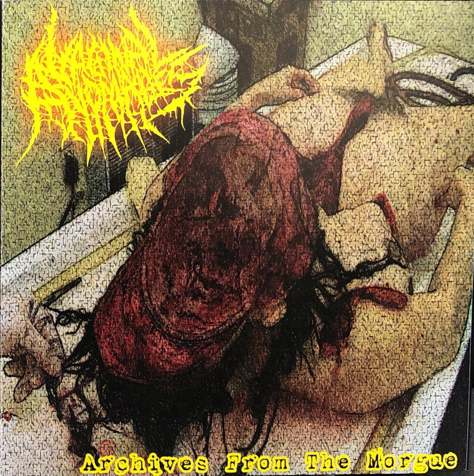 Vaginal Anomalies - Archives From The Morge CD