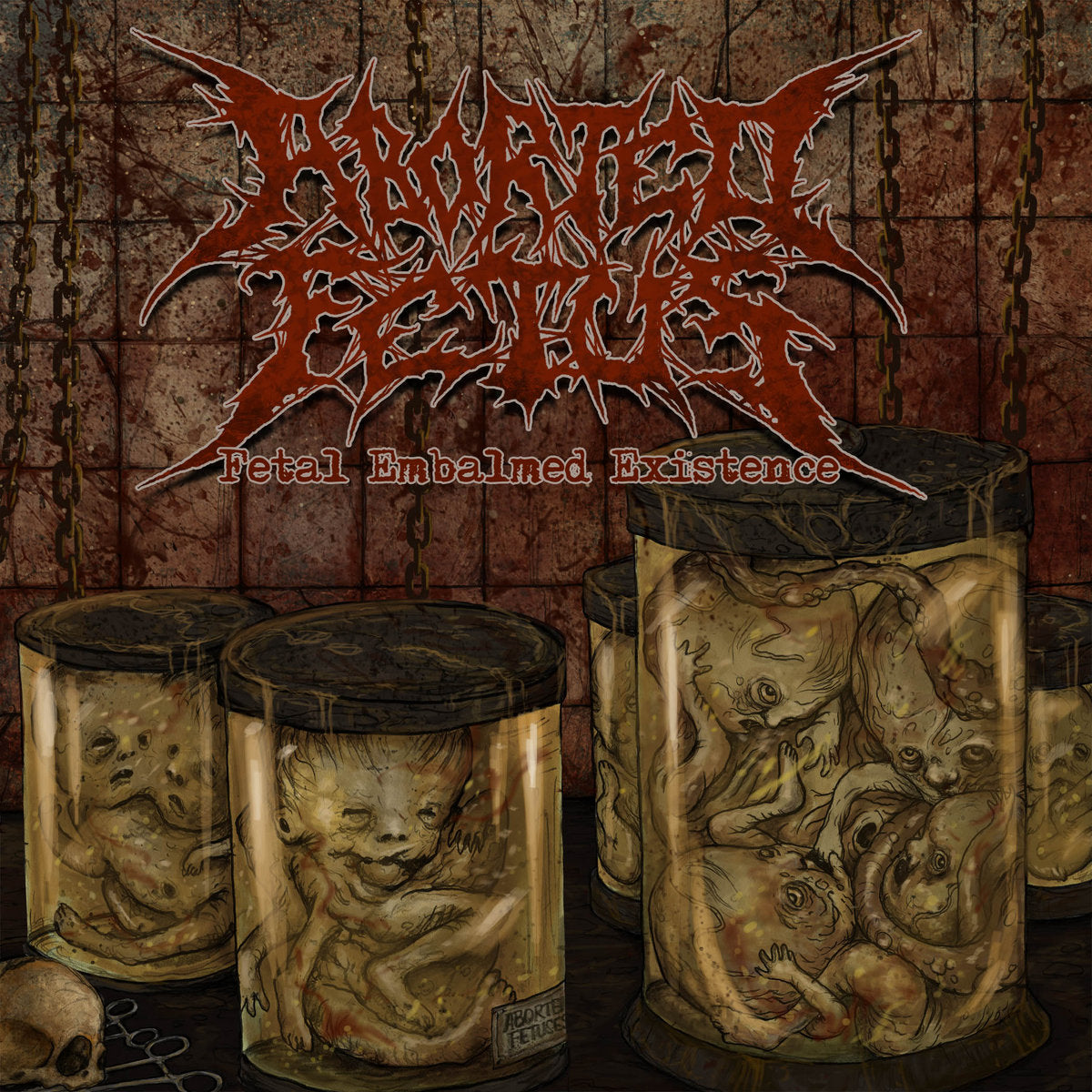 Aborted Fetus - Fetal Embalmed Existence CD cover art