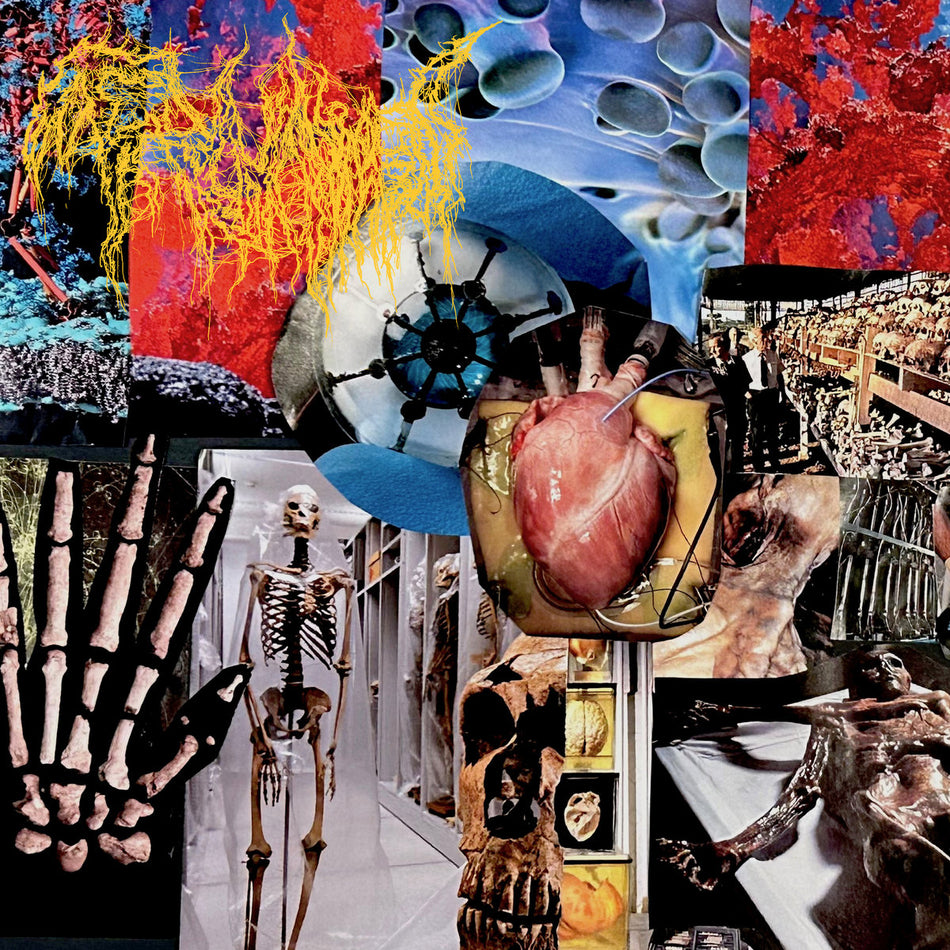 Trichomoniasis - Harvest Of The Killing Fields CD cover art